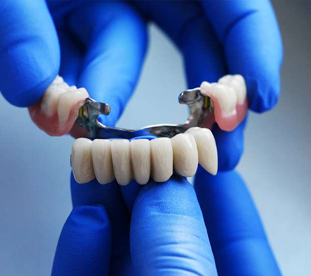 Santa Clarita Dental Bridges