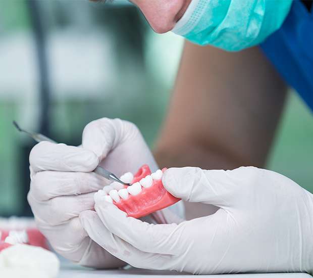 Santa Clarita Partial Denture for One Missing Tooth