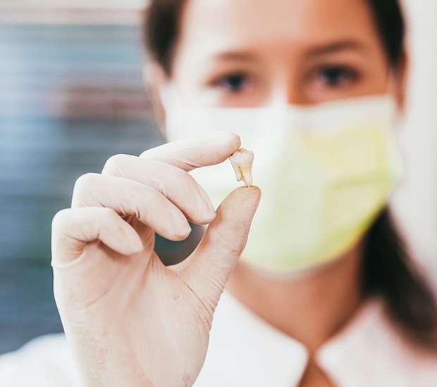 Santa Clarita Tooth Extraction